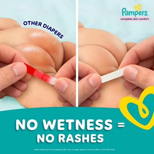 Pampers Complete Skin Comfort Pants, (M) 76 Count, Anti-rash blanket, Lotion with Vitamin E & Aloe Vera, Medium, 7-12kg